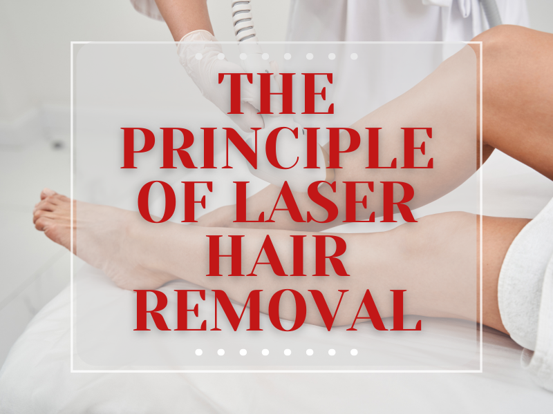 The Principle Of Laser Hair Removal