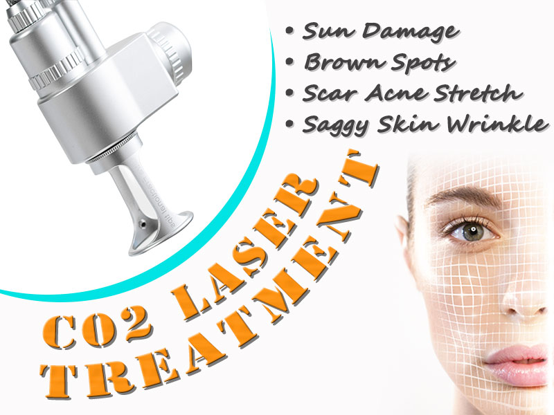 Will recover immediately after CO2 Laser treatment?