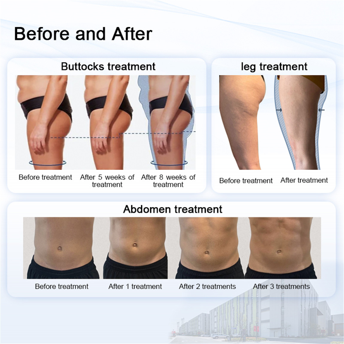 EMS Body Contouring Principles02xc1