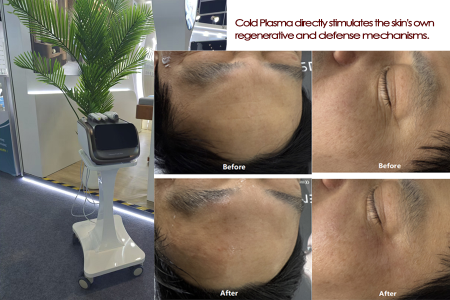 Plasma 1-1.jpg