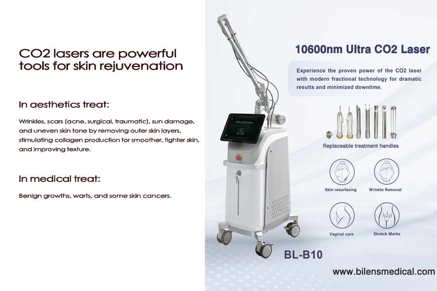 Les lasers CO2 BILENS sont des outils puissants pour le rajeunissement de la peau.