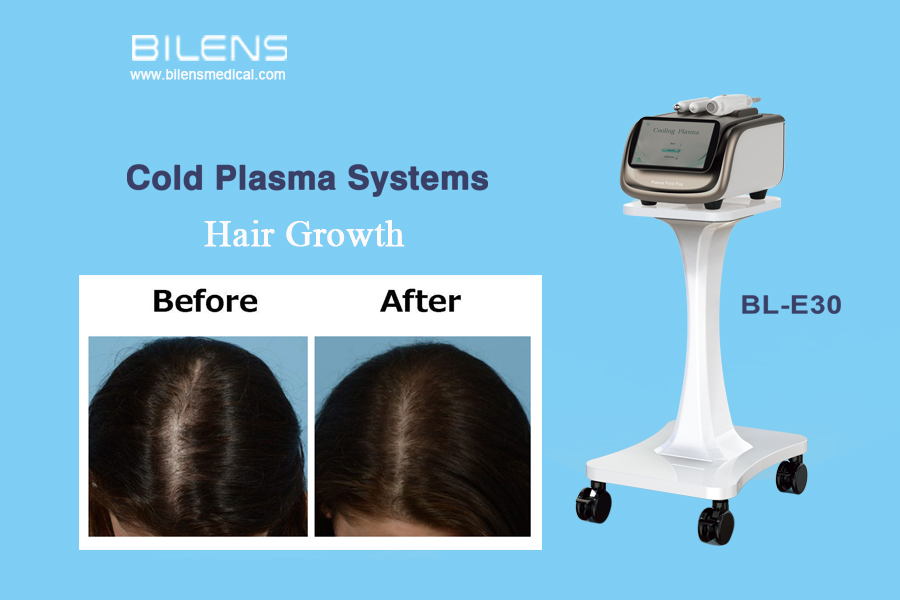 Why choose cold plasma for hair growth?