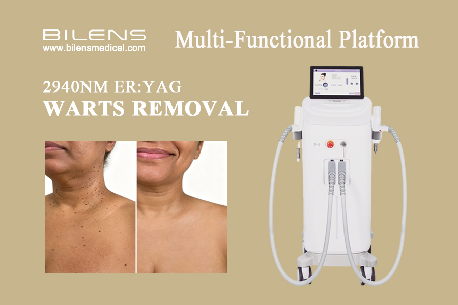 2940nm er yag laser warts removal.jpg