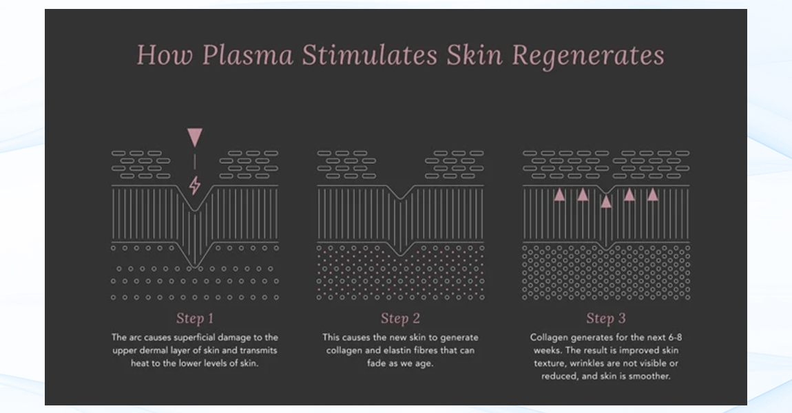 Cold Plasma principle