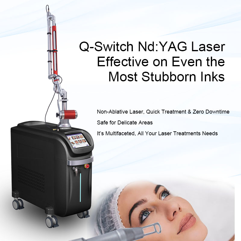 Q-Switch Nd: YAG Laser Effective on Even the Most Stubborn Inks