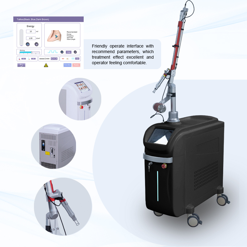 Q-Switch Nd: YAG Laser Effective on Even the Most Stubborn Inks-product