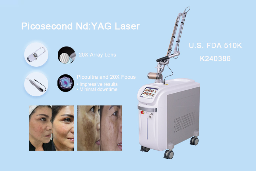 How picosecond laser remove melasma?