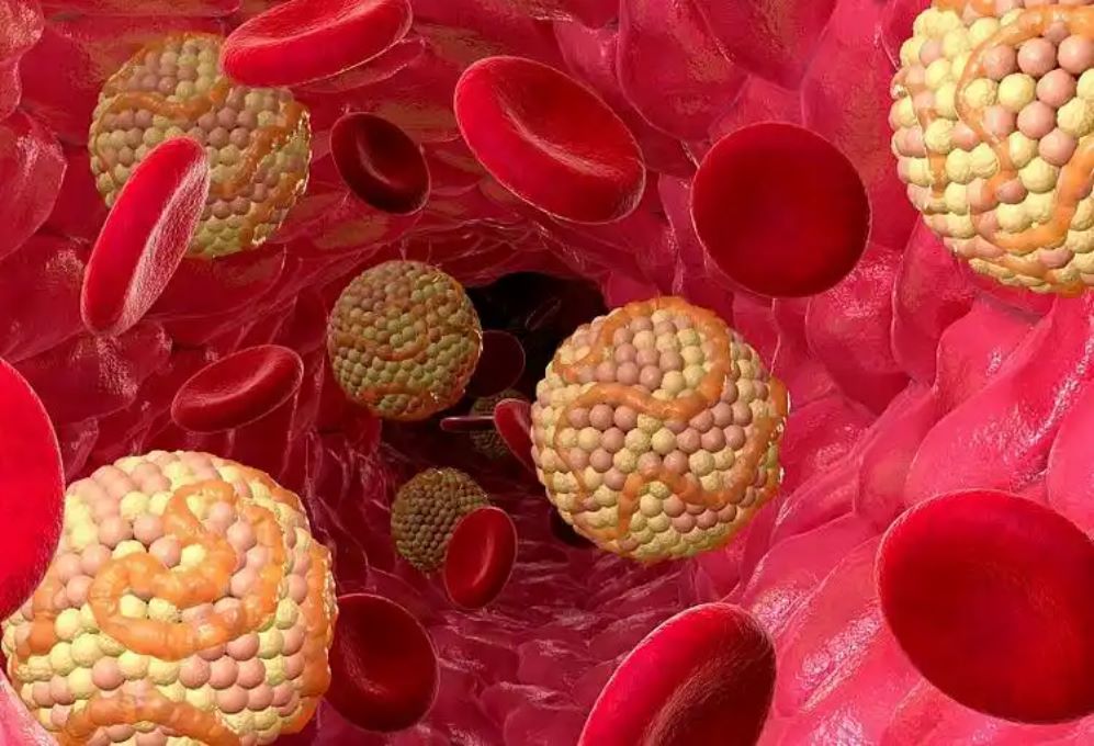 Dietary cholesterol or egg intake and cardiovascular disease and mortality