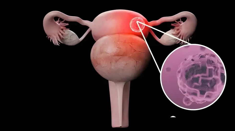 Improved ovarian structure.jpg
