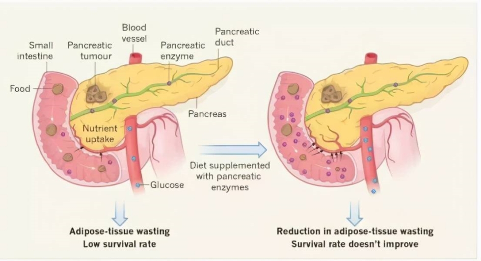 Lipase pancreática.jpg