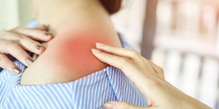 What is the difference between betulin and betulinic acid