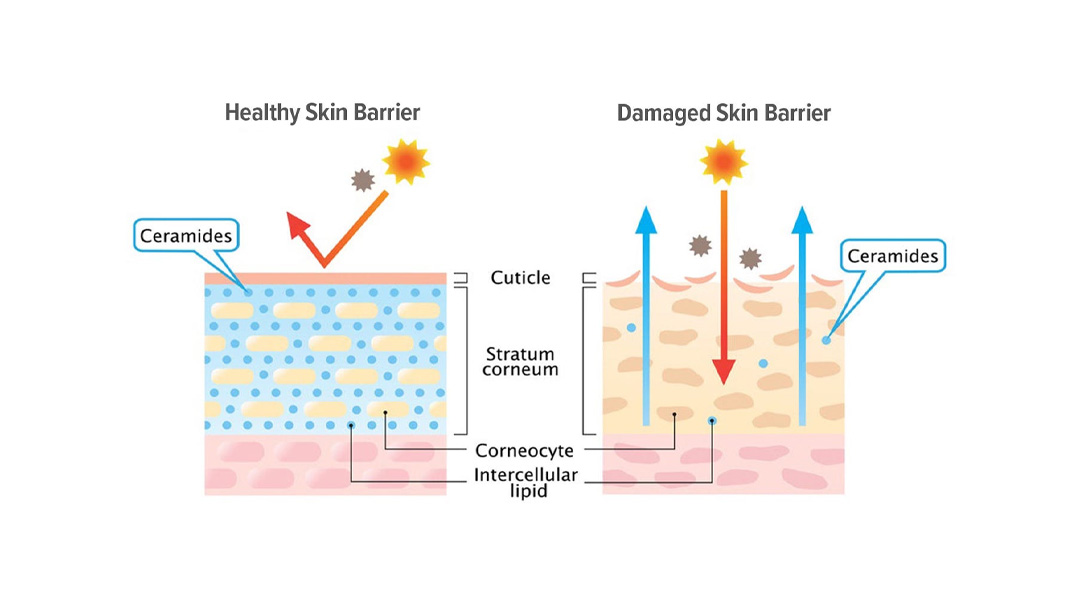Ceramide is one of the main components of the stratum corneum of the skin