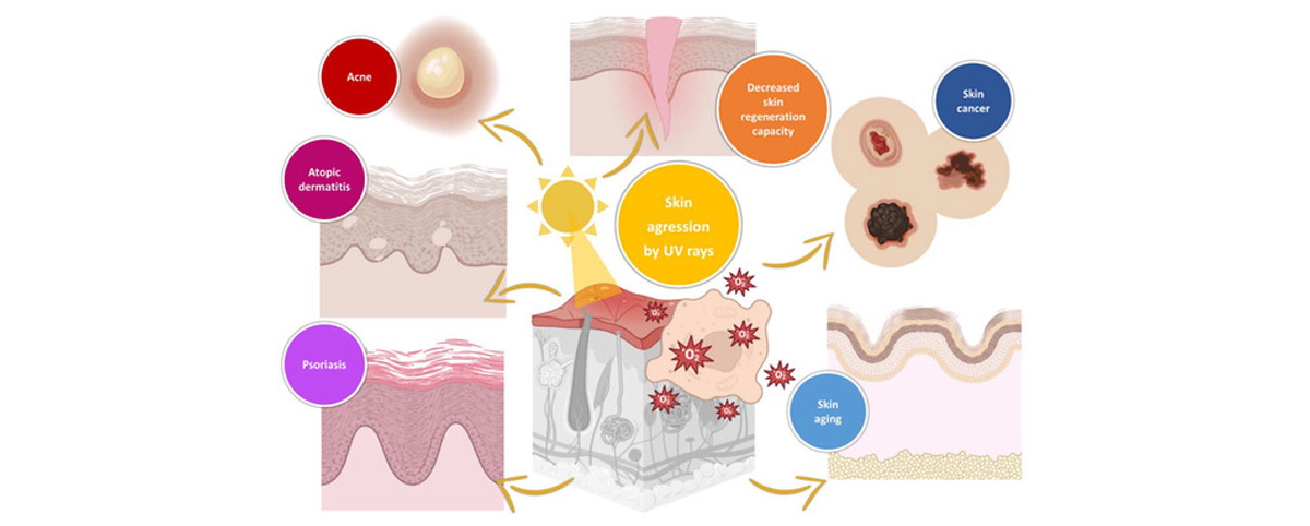 Gamma Oryzanol can Protect skin health