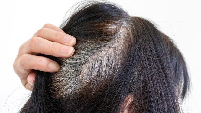 Can Luteolin Supplements Turn Gray Hair to Black Hair？