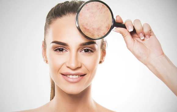 What Makes Baicalin Beneficial For the Skin