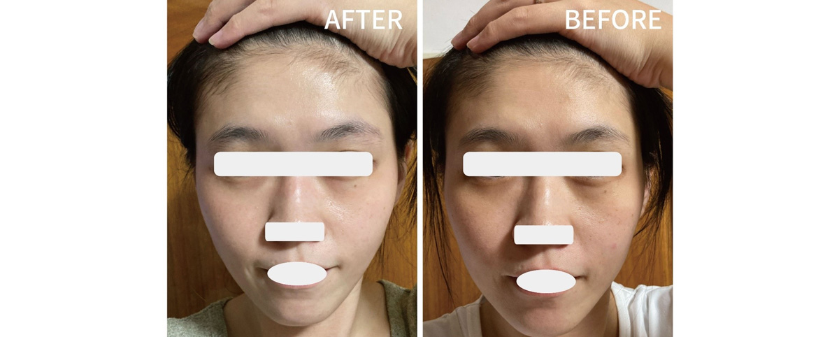 Tetrahydrocurcumin can reduce melanin production, helping to brighten skin tone and fade dark spots