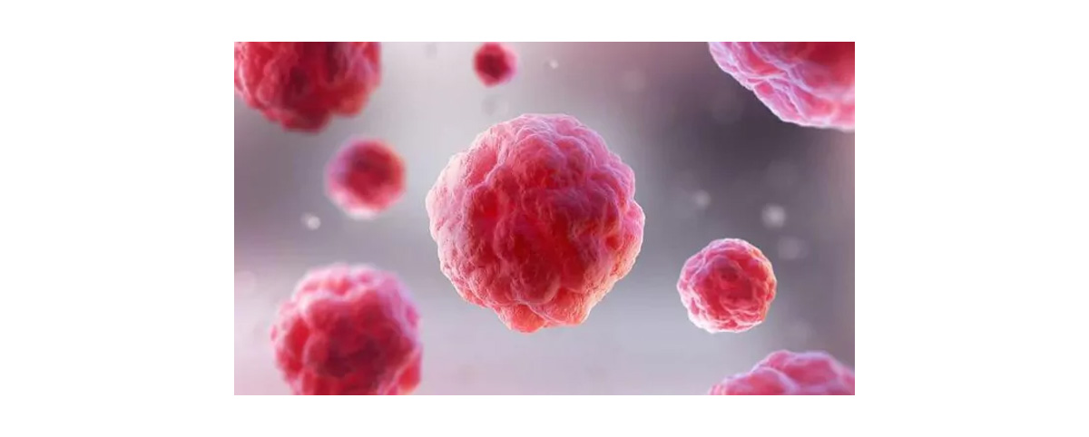 Podophyllotoxin inhibits the polymerization of tubulin, preventing the mitosis of cancer cells