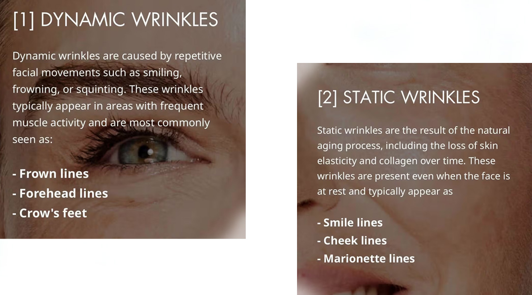 Pro-Xylane Angnist for Wrinkles