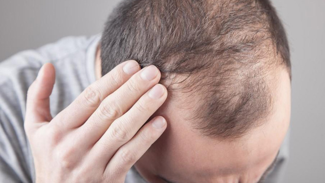Pueraria Mirifica Stimulates hair growth.jpg