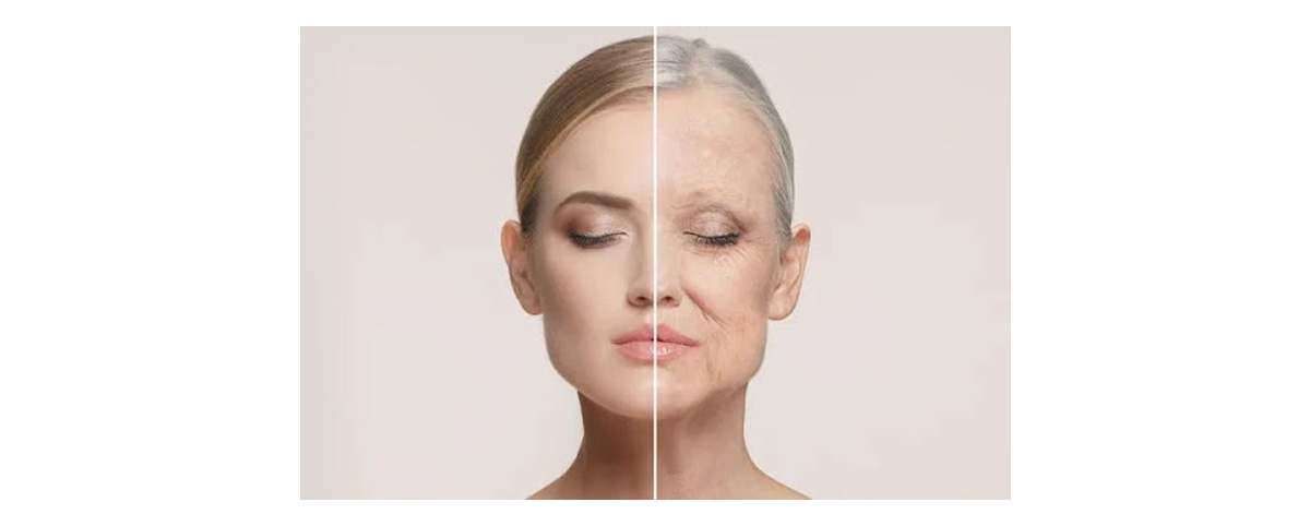 Puerarin delays skin aging