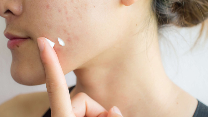What effects are associated with glycyrrhetinic acid for skin