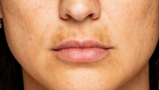 alpha arbutin focuses on brightening skin tone and reducing pigmentation.jpg