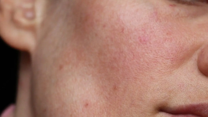 Gingerols have significant anti-inflammatory properties.jpg