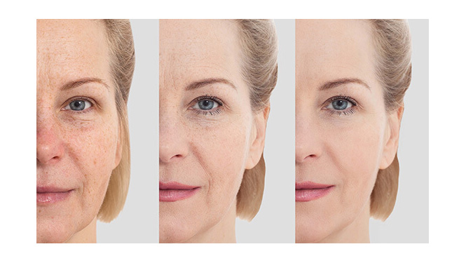 Indole 3 carbinol reduces oxidative damage.jpg
