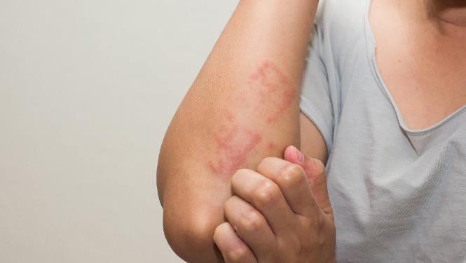 Octacosanol may effectively alleviate these inflammatory reactions.jpg