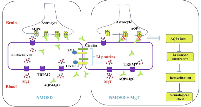 Magnesium L-threonate For Anxiety