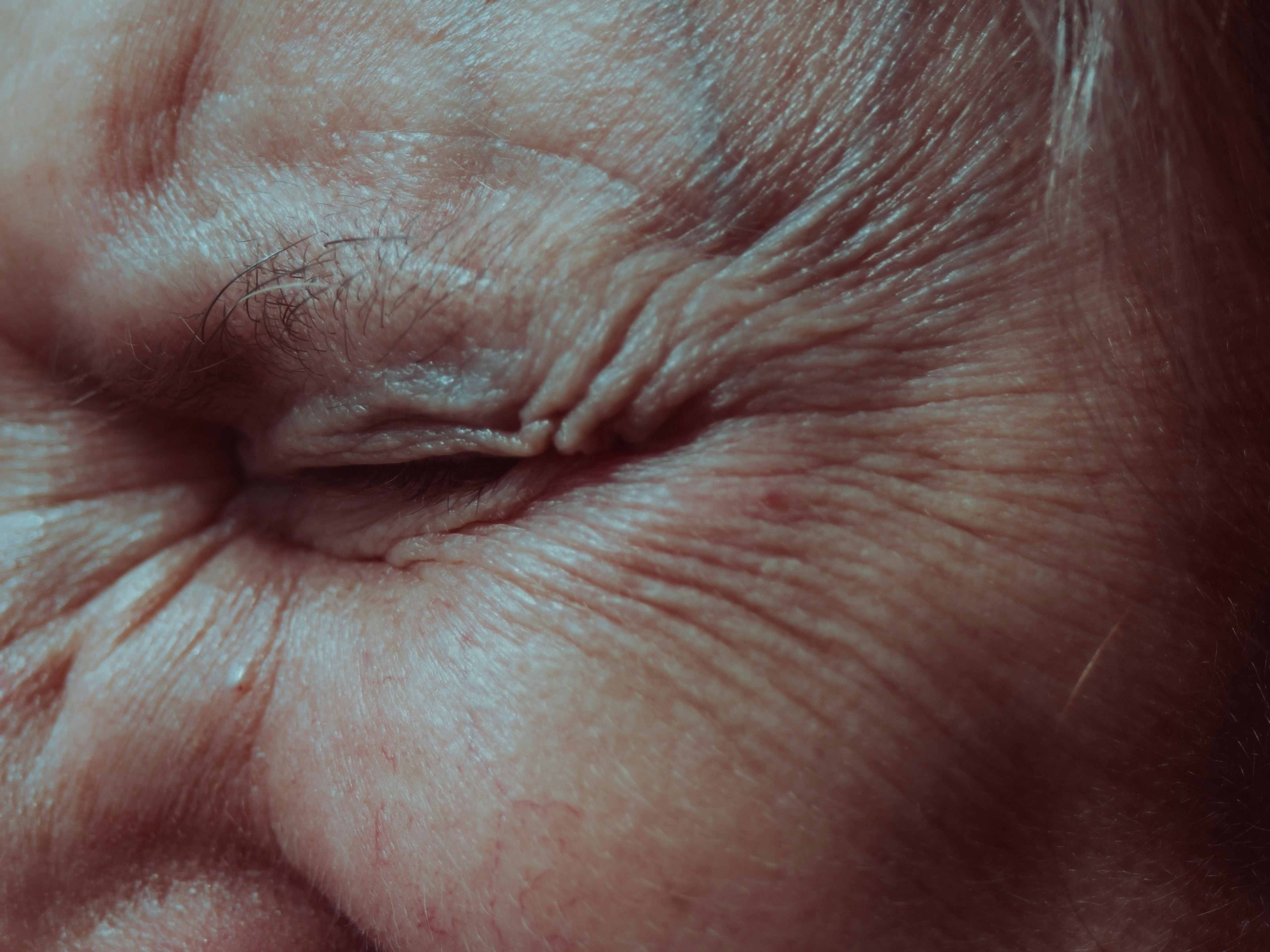 argireline anti wrinkle