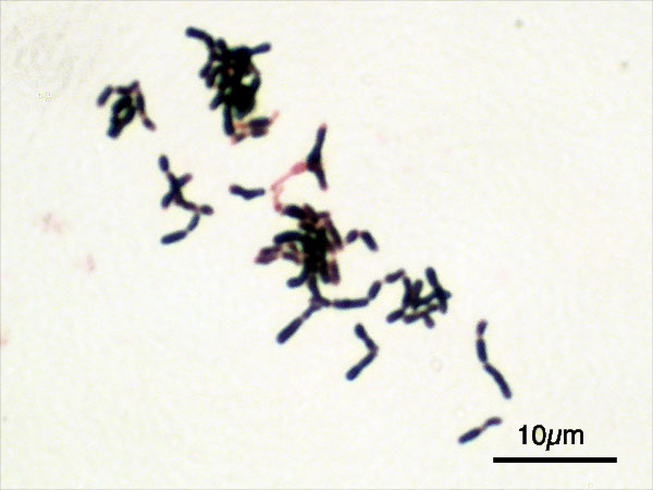 bifidobacterium adolescentis