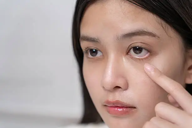 Improvement of skin quality