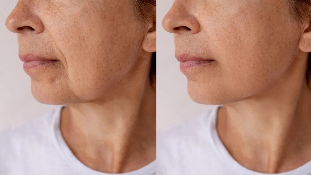Maintaining skin elasticity