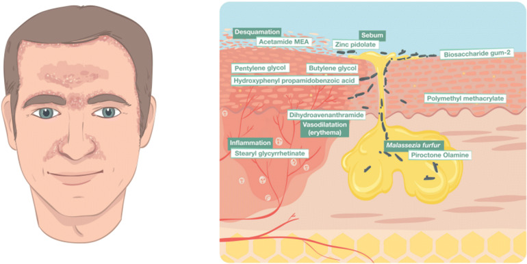 piroctone olamine skin benefits