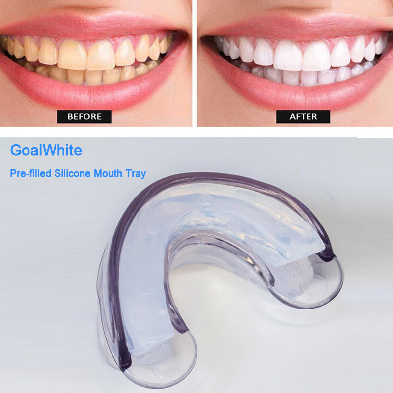 Pre-filled Silicone Gel Teeth Whitening Mouth Tray, Double Sided Mouthpiece, Dental Dual Soft Tray, Silicone Strip Mouth Tray, Food Grade Material, Home Use, Comfort for All Mouth