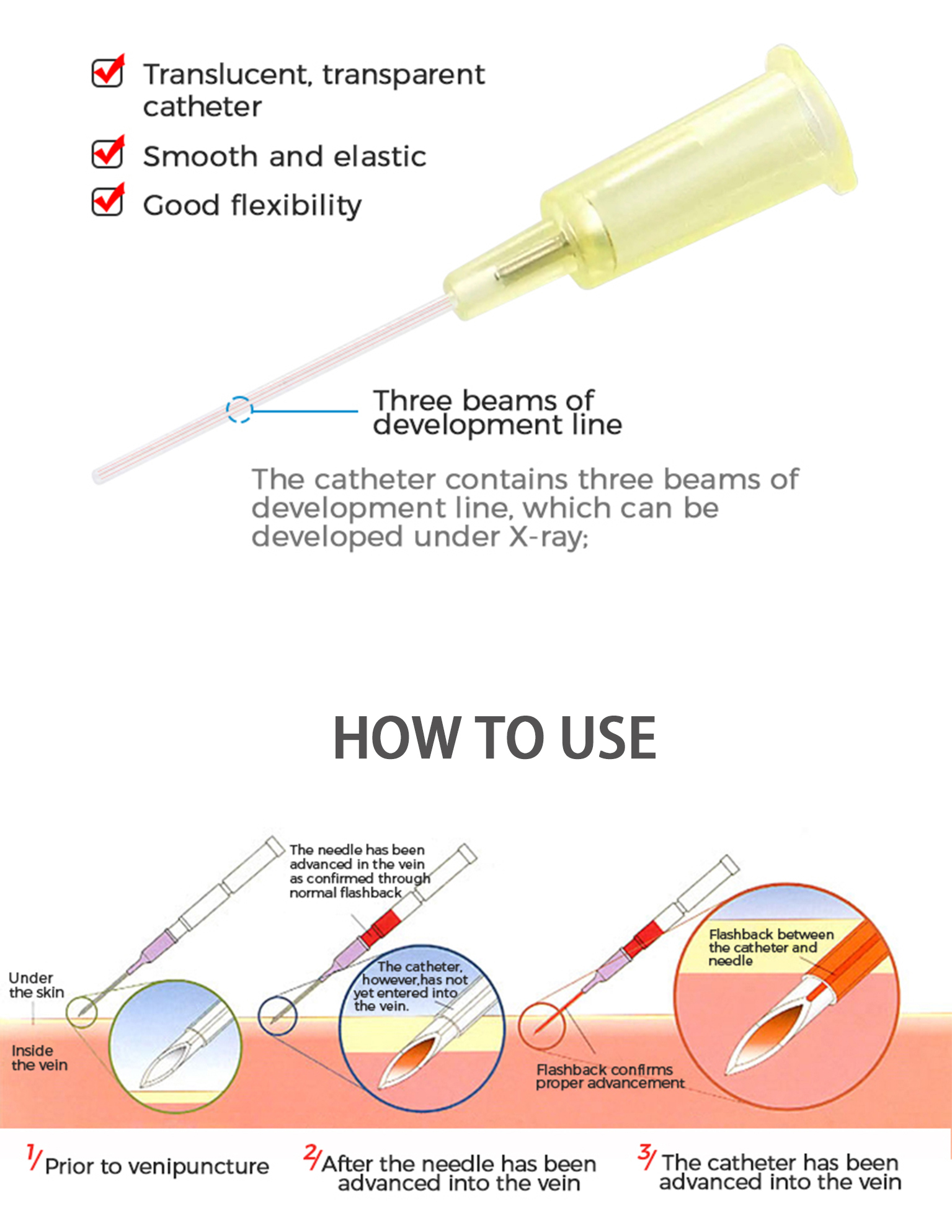 IV cannula 05