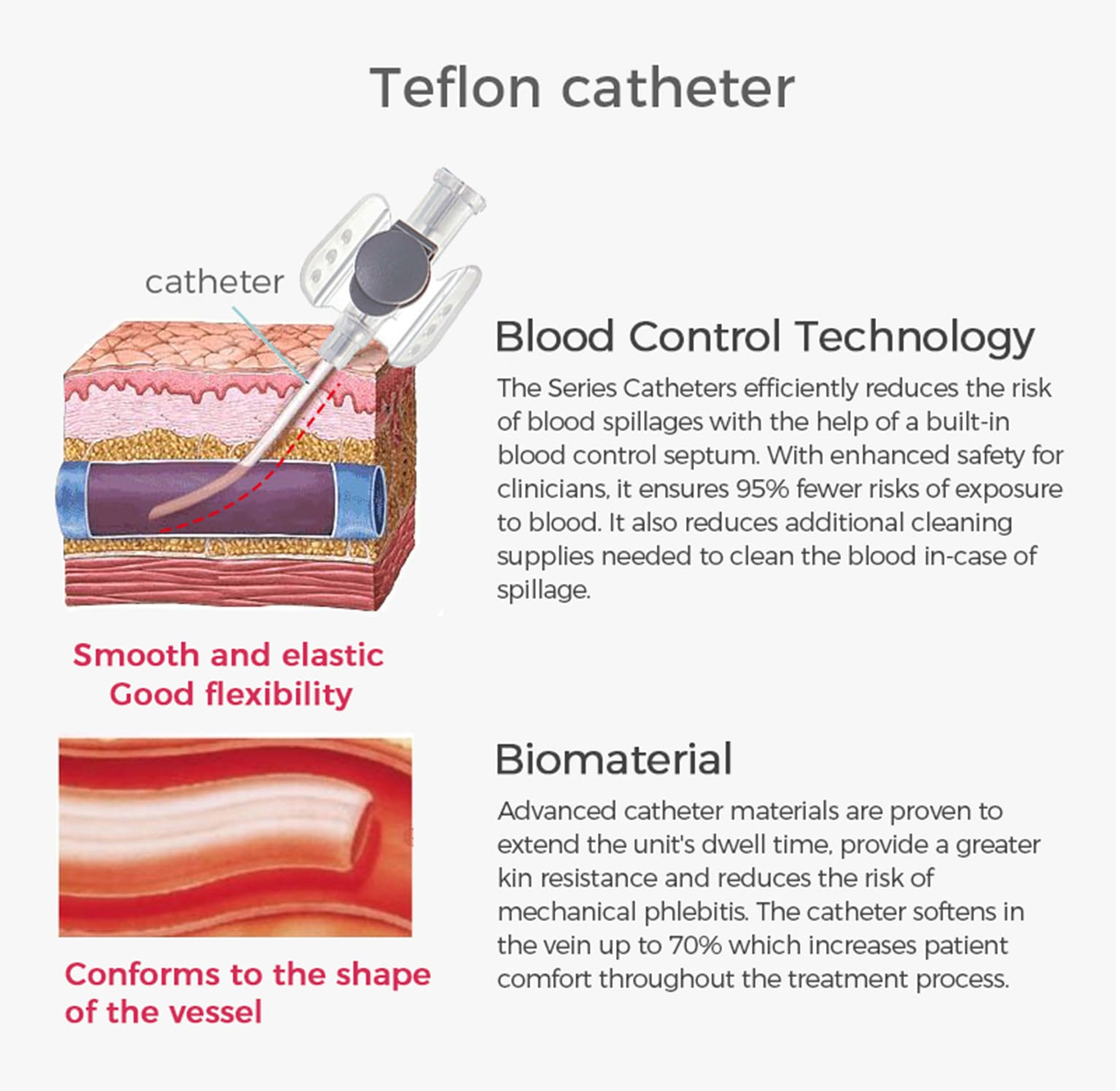 IV catheter 02
