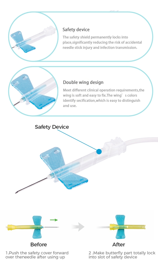 Safety scalp vein set 01