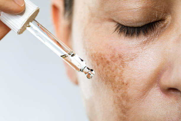 istockphoto-1456638962-612x612