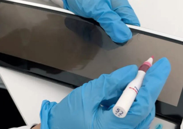 الدور الحاسم لاختبار مستوى داين في عمليات الطلاء AG و AR و AF