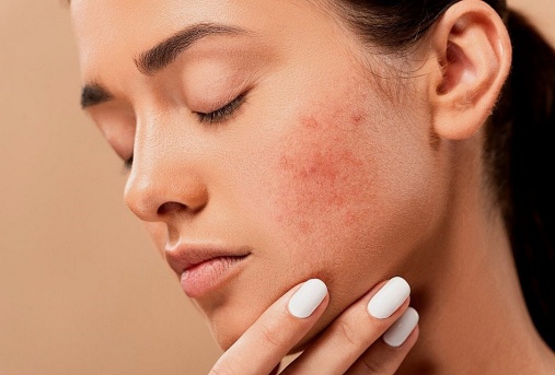 antioxidant-and-anti-inflammatory