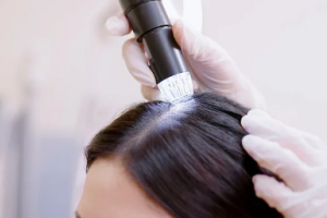 hair