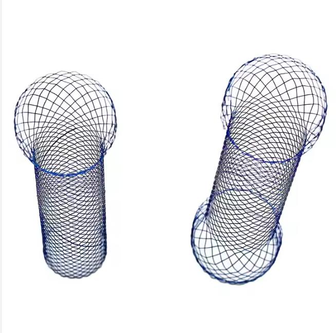 Gastrointestinal stent