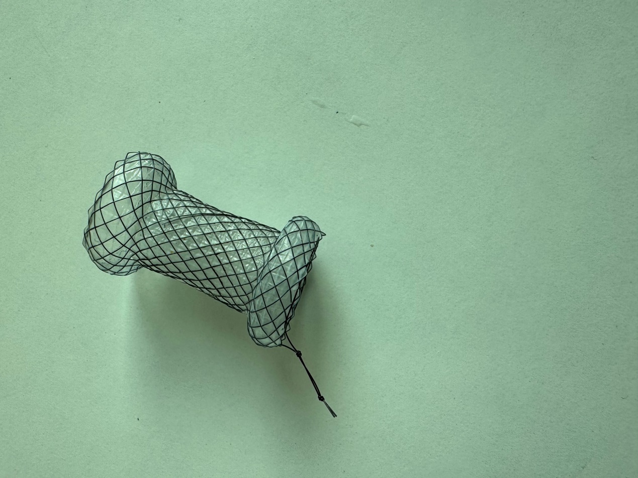 Pancreatic cyst metal drainage stent