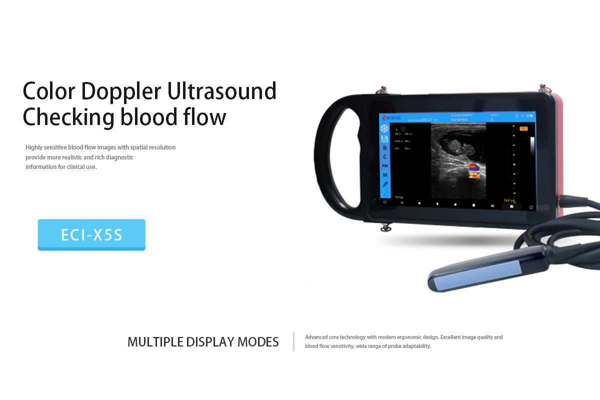 ECI-X5S Veterinary Ultrasound Scanner-detail 12