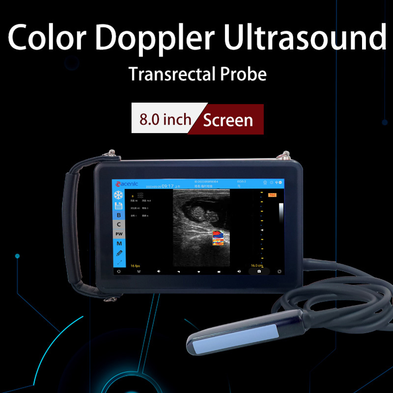 ECI-X5S Veterinary Ultrasound Scanner-detail 9