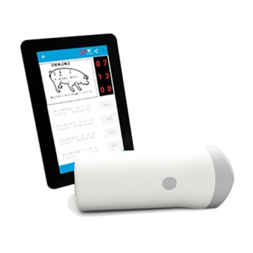 Iskena se-Ultrasound esiphathwayo esingenazingcingo se-ECI-300W