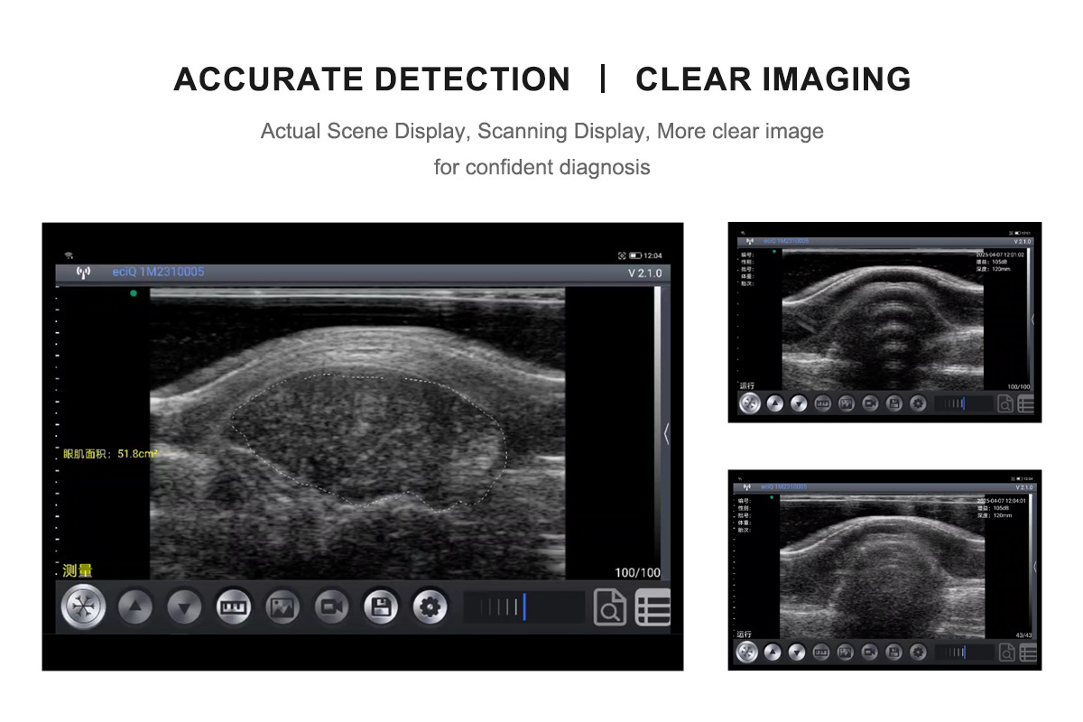 ECI-E128 Wireless Loin Eye Muscle Measuring Instrument-detail 2
