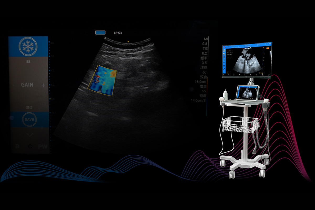 ECI-E7 Portable Veterinary Ultrasound Scanner-detail 2
